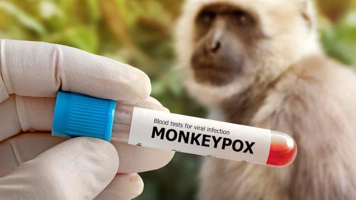 PAFI MAGETAN : WHO Undang Produsen Vaksin Monkeypox Serahkan Berkas untuk Evaluasi Darurat